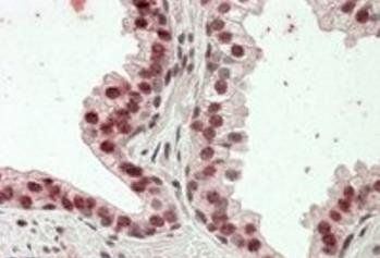 Goat anti-HOXD13 Antibody