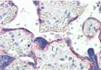 Goat anti-BOD1 Antibody