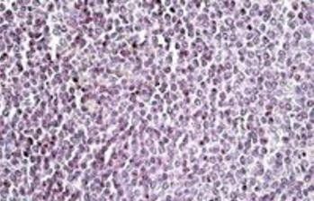Goat anti-AIM2 Antibody