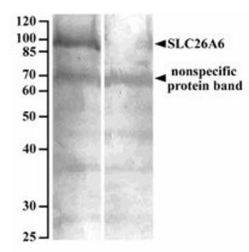SLC26A6 antibody