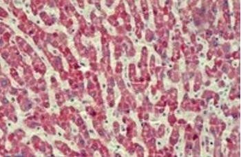 Goat anti-ANTXR2 / CMG2 Antibody