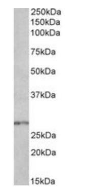HOXB9 antibody