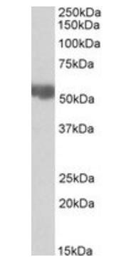 Goat anti-ALDH3A2 Antibody