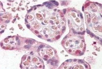 Goat anti-FANCE Antibody