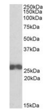 Goat anti-ARHGDIB Antibody