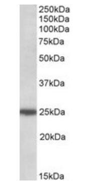 Goat anti-ARHGDIG Antibody
