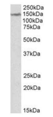 Goat anti-LMTK2 Antibody