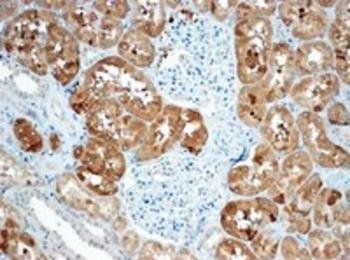 Goat anti-SOST Antibody