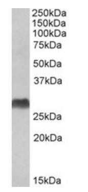 HLA-DQA2 antibody