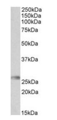 HLA-DQA2 antibody