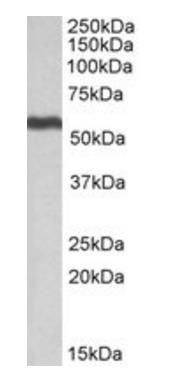 Goat anti-ALDH5A1 (aa 485-496) Antibody