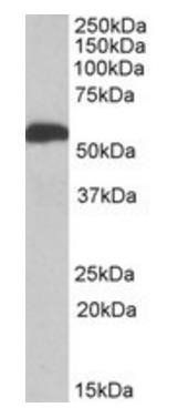 Goat anti-ALDH5A1 (aa 301-312) Antibody