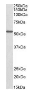 Goat anti-ALDH6A1 (aa487-496), Biotinylated Antibody