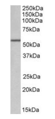 Goat anti-ALDH6A1 (aa487-496) Antibody
