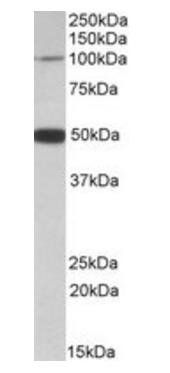 Goat anti-PTCHD1 Antibody