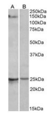 RBM20 antibody