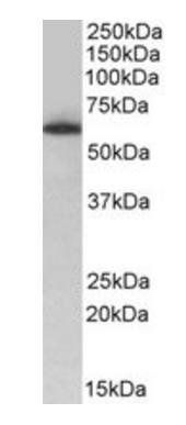 TH1L antibody