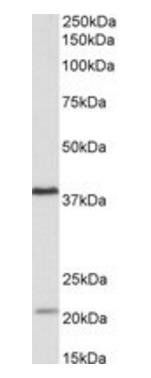 KLHDC8B antibody