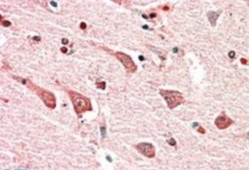 Goat anti-MYO1B Antibody