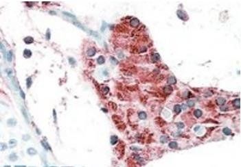 Goat anti-TIAM2 Antibody