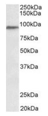 Goat anti-PTCHD3 Antibody