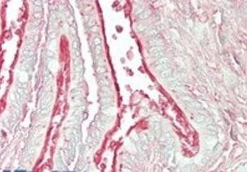 Goat anti-Arl6 / BBS3 (mouse) Antibody