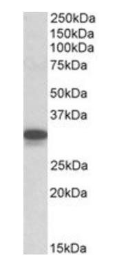 Goat anti-CYB5R3 / Dia 1 (mouse) Antibody