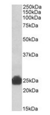 Goat anti-Gsta3/Gsta5/Gst Yc2 (rat) Antibody