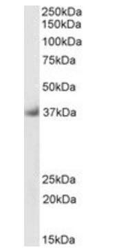 Goat anti-Delta-Sarcoglycan (aa245-257), Biotinylated Antibody