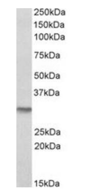 Goat anti-NQO1 (isoform a) Antibody