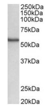 Goat anti-NDR1 / STK38 Antibody