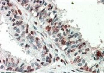 Goat anti-ZIC3 (aa178-189) Antibody