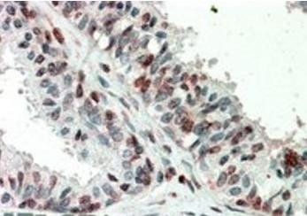 ZIC3 antibody