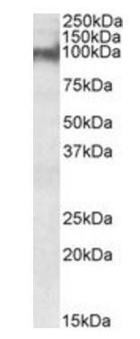 Plakophilin 2 antibody