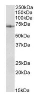 PDIA2 antibody