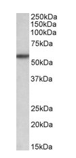 TGFBR1 antibody