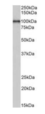 Goat anti-ADAM12 (aa225-239) Antibody