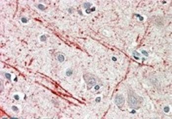 Goat anti-IGF2 (aa81-93) Antibody