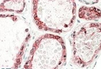 Goat anti-Thyroid peroxidase Antibody