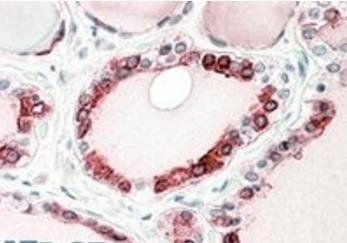 Goat anti-thyroid peroxidase Antibody