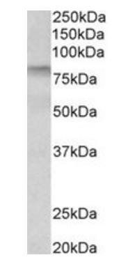Goat anti-Transglutaminase 3 (aa598-610) Antibody