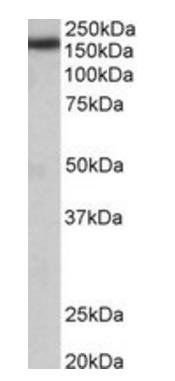 Goat anti-Terminal Uridylyltransferase 4 (mouse) Antibody
