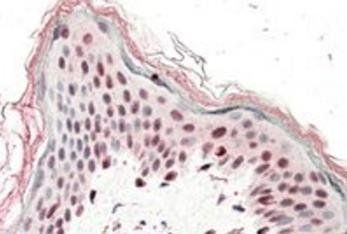 Goat anti-SRCAP (aa309-322) Antibody