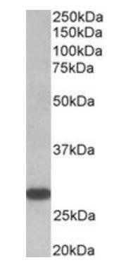 Goat anti-TSHR (aa101-115) Antibody