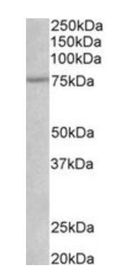 Goat anti-p75NTR / CD271 (aa202-215) Antibody