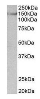 Goat anti-SYNGAP1 (aa1169-1183) Antibody
