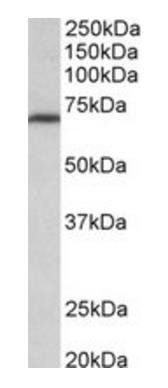 Goat anti-MTHFR (aa369-383) Antibody