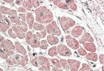 Goat anti-Atrial natriuretic factor Antibody