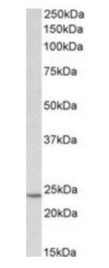 Goat anti-TIMP1 (aa129-143) Antibody