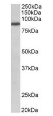 Goat anti-FGFR1 Antibody
